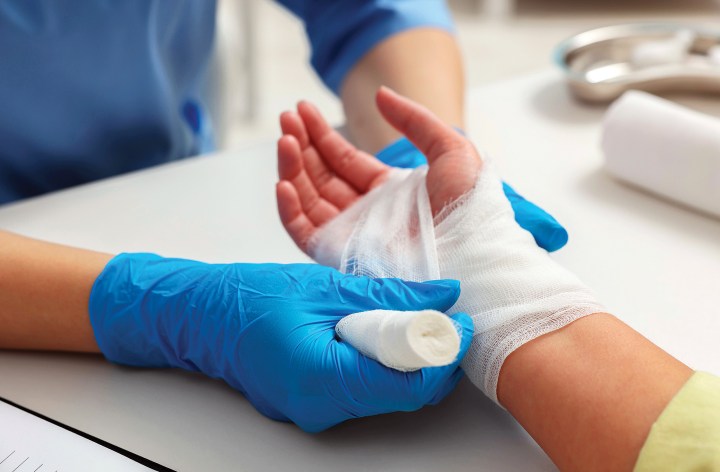 A medical responder wearing blue nitrile gloves carefully wrapping a sterile gauze bandage around a patient's burned hand and wrist.